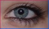  Recovered= Achromatopsia: Eye, Inability to see colours- SYMMETRYBODY