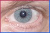 Recovered= Floaters: Eye, ‘Myodesopsia’ - light flashes in the eyes, risk of detached retina- SYMMETRYBODY
