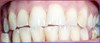 Asymmetrybody deteriorating teeth and gums- Before movement treatment- SYMMETRYBODY